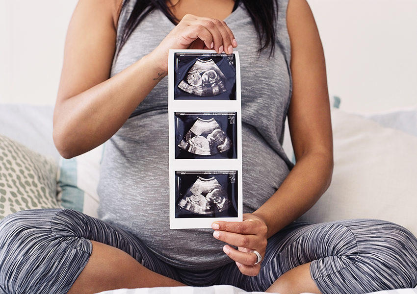 Woman holding up ultrasound image